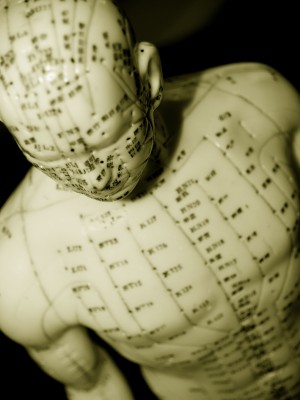 1080504_s acupuncture 123rf