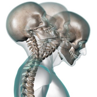 iStock_000006945203Small Whiplash